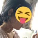 その他（輪郭） 品川美容外科 静岡院 DAY 63 サムネイル用