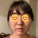 毛穴洗浄（ハイドラフェイシャルなど） 自由が丘クリニック AFTER サムネイル用