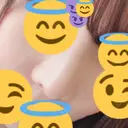 鼻尖形成（切開） / 鼻中隔延長（切開） / 軟骨移植 / 鼻翼基部形成（貴族手術） HANABI整形外科 DAY 16 サムネイル用