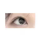 二重切開 神野美容形成外科クリニック DAY 109 サムネイル用