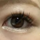 二重埋没 / 脂肪吸引（顔） 表参道スキンクリニック 表参道院 DAY 12 サムネイル用