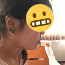 その他（輪郭） 品川美容外科 静岡院 AFTER サムネイル用