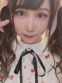 眼瞼下垂（切開） ビスポーククリニック 福岡院 DAY 42 サムネイル用