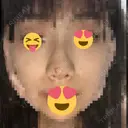 小鼻縮小（切開） / スレッドノーズ / ヒアルロン酸注入（鼻） キップン整形外科 DAY 0 サムネイル用