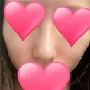 鼻中隔延長（切開） / 骨切幅寄せ / ワシ鼻修正・ハンプ切除 表参道スキンクリニック 表参道院 DAY 29 サムネイル用