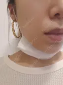 ニキビ治療 品川美容外科 仙台院 DAY 0 サムネイル用