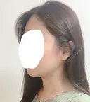 糸リフト / 骨切り（あご） / 骨削り（エラ） / 骨削り（頬） / 脂肪吸引（顔） RG整形外科（旧リオン整形外科） DAY 188 サムネイル用