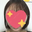 脂肪吸引（顔） / ボトックス（エラ・小顔） 銀座マイアミ美容外科 AFTER サムネイル用