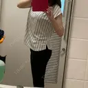 脂肪吸引（脚） / 豊胸（脂肪注入） 南クリニック DAY 31 サムネイル用