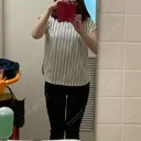 脂肪吸引（脚） / 豊胸（脂肪注入） 南クリニック DAY 31 サムネイル用