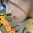 小鼻縮小（切開） / スレッドノーズ / ヒアルロン酸注入（鼻） キップン整形外科 AFTER サムネイル用