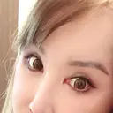 眼瞼下垂（切開） / クマ治療 / 目尻切開 / 下まぶたたるみ取り / 下まぶたの脂肪取り / タレ目形成・グラマラスライン（切開） / 眉下切開 id（アイディ）美容外科 AFTER サムネイル用