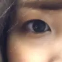 二重埋没 高須クリニック 名古屋院 DAY 55 サムネイル用