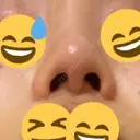 二重切開 / 目頭切開 / 鼻尖形成（切開） / 鼻中隔延長（切開） / 小鼻縮小（切開） / タレ目形成・グラマラスライン（切開） / 鼻尖縮小 / 鼻翼基部形成（貴族手術） グローバルビューティークリニック 大阪院 DAY 170 サムネイル用