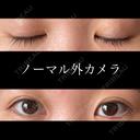 二重埋没 東京形成美容外科 船橋院 DAY 113 サムネイル用