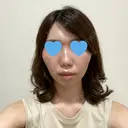 脂肪溶解注射（顔） 赤坂プレミアクリニック DAY 5 サムネイル用