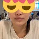 ヒアルロン酸注入（あご） / その他（輪郭） 東京形成美容外科 船橋院 DAY 0 サムネイル用