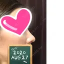 鼻尖形成（切開） / 小鼻縮小（切開） / 軟骨移植 湘南美容クリニック 船橋院 DAY 18 サムネイル用