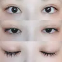 二重切開 / 目頭切開 / 上まぶたたるみ取り 湘南美容クリニック 金沢院 DAY 174 サムネイル用