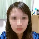 ボトックス（エラ・小顔） 湘南美容クリニック 静岡院 AFTER サムネイル用