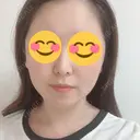 糸リフト / 骨切り（あご） / 骨削り（エラ） / 骨削り（頬） / 脂肪吸引（顔） RG整形外科（旧リオン整形外科） AFTER サムネイル用