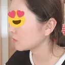 糸リフト / 骨切り（あご） / 骨削り（エラ） / 骨削り（頬） / 脂肪吸引（顔） RG整形外科（旧リオン整形外科） DAY 258 サムネイル用