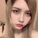 ガミースマイル手術 / セットバック / ルフォー+ssro（両あご) / 輪郭修正 / 矯正（ワイヤー） クラインデンタルクリニック AFTER サムネイル用