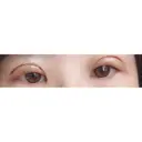 眼瞼下垂（切開） リビジョンクリニック（旧：池本形成外科・美容外科） DAY 2 サムネイル用