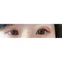 眼瞼下垂（切開） リビジョンクリニック（旧：池本形成外科・美容外科） DAY 17 サムネイル用