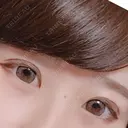 眼瞼下垂（切開） リビジョンクリニック（旧：池本形成外科・美容外科） AFTER サムネイル用
