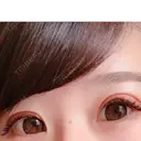 眼瞼下垂（切開） リビジョンクリニック（旧：池本形成外科・美容外科） DAY 21 サムネイル用