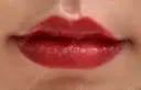 アートメイク（唇） LETICIA CLINIC（レティシア クリニック） AFTER サムネイル用