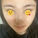 隆鼻術 湘南美容クリニック 岡山院 DAY 0 サムネイル用