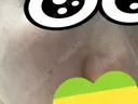 美容点滴・美容注射（美肌） / ダーマペン 品川スキンクリニック京都院 DAY 2 サムネイル用