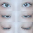 二重切開 / 目頭切開 / 上まぶたたるみ取り 湘南美容クリニック 金沢院 AFTER サムネイル用