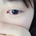 二重埋没 かわた美容クリニック DAY 192 サムネイル用