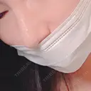 鼻中隔延長（切開） / 骨切幅寄せ / ワシ鼻修正・ハンプ切除 表参道スキンクリニック 表参道院 AFTER サムネイル用