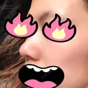 鼻尖形成（切開） / 小鼻縮小（切開） / 軟骨移植 湘南美容クリニック 船橋院 DAY 61 サムネイル用