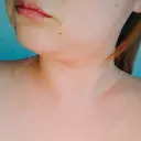 脂肪溶解注射（顔） / 脂肪溶解注射（二の腕） / ボトックス（肩） / その他（ボディ） 品川スキンクリニック京都院 AFTER サムネイル用