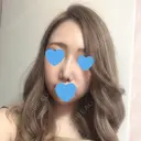 鼻尖形成（切開） / 軟骨移植 / 眉間プロテーゼ / 鼻尖縮小 湘南美容クリニック 柏院 AFTER サムネイル用
