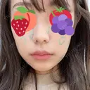 脂肪溶解注射（顔） / 美容点滴・美容注射（美肌） / ボトックス（肩） / ハイフ（顔） リエンジャン整形外科 江南店 AFTER サムネイル用