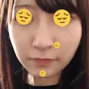 隆鼻術 / 鼻尖形成（切開） / 軟骨移植 / 鼻修正 湘南美容クリニック 柏院 AFTER サムネイル用