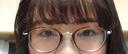 二重埋没 / 目頭切開 湘南美容クリニック 京都院 DAY 5 サムネイル用