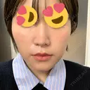脂肪溶解注射（顔） 赤坂プレミアクリニック DAY 12 サムネイル用