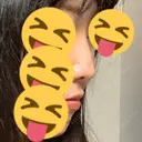 その他（鼻） 聖心美容クリニック 大阪院 DAY 2 サムネイル用