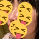 その他（鼻） 聖心美容クリニック 大阪院 DAY 14 サムネイル用