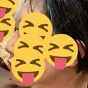 その他（鼻） 聖心美容クリニック 大阪院 DAY 26 サムネイル用