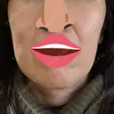 ボトックス（エラ・小顔） 湘南美容クリニック 藤沢院 DAY 4 サムネイル用