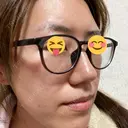 脂肪溶解注射（顔） / PRP皮膚再生療法 閉院｜プルージュ美容クリニック 赤羽院 DAY 14 サムネイル用
