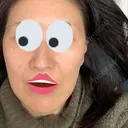 ボトックス（エラ・小顔） 湘南美容クリニック 藤沢院 DAY 11 サムネイル用